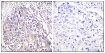 FoxO1/3/4 (phospho Thr24/32) rabbit pAb