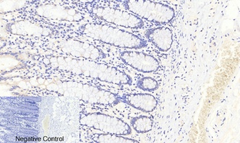 FoxO3A (phospho-Ser253) antibody