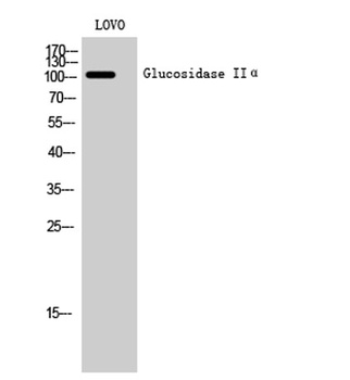 Glucosidase IIalpha antibody