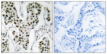 ZC3H4 antibody