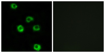 Latrophilin-2 rabbit pAb