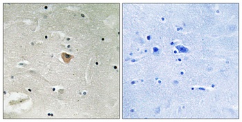 KIF13B rabbit pAb