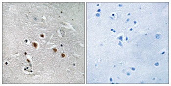 TRAP240 antibody