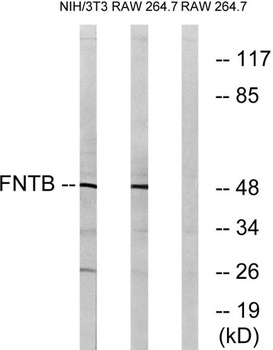 FTbeta antibody