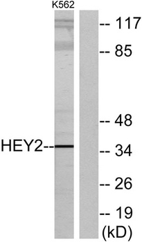 HRT2 rabbit pAb