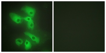 JIP-2 antibody