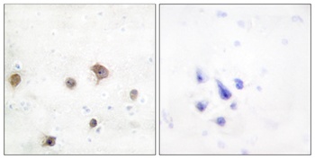 JIP-2 rabbit pAb Antibody