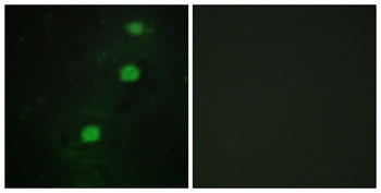 CCRK antibody