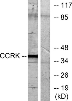 CCRK rabbit pAb Antibody