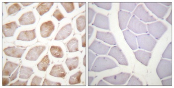 DAPK2 (phospho Ser318) rabbit pAb Antibody