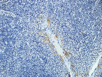 DAPK2 antibody