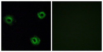 NTR2 antibody