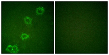 BACE rabbit pAb Antibody
