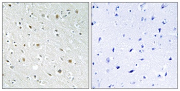 SSBP2 antibody