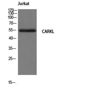 CARKL rabbit pAb