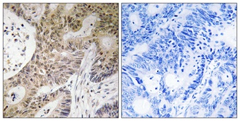 PRP6 antibody