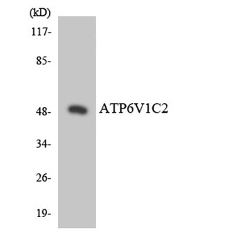 V-ATPase C2 rabbit pAb Antibody