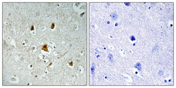 Abl1 (phospho-Tyr204) antibody