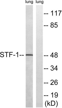 SF-1 antibody