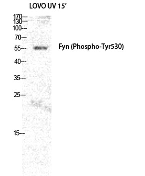 Fyn (phospho-Tyr530) antibody