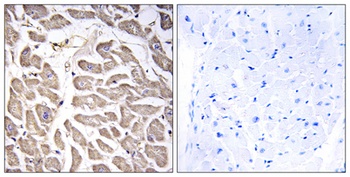 BRWD3 antibody