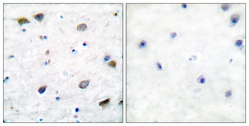 GABAA Rβ1 rabbit pAb