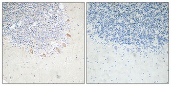 GABAA R beta 2 antibody