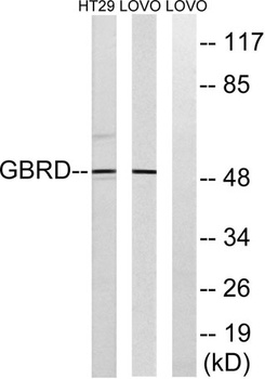 GABAA R delta antibody