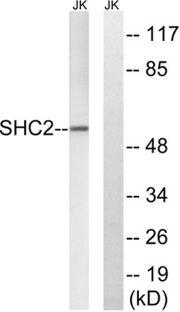 Sck antibody