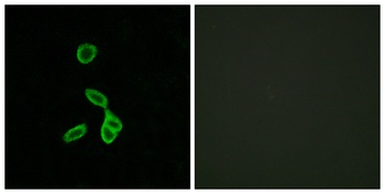 GALR1 antibody