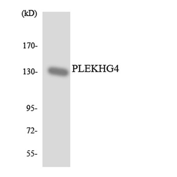 Puratrophin 1 rabbit pAb