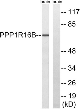 TIMAP antibody