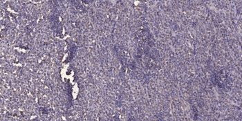 TIMAP rabbit pAb Antibody