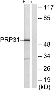 PRPF31 rabbit pAb