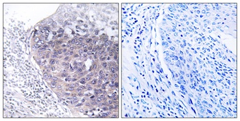 GTPBP5 antibody