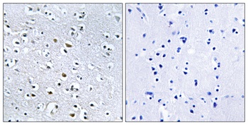 Nephrocystin-4 antibody