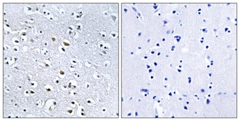 Nephrocystin-4 rabbit pAb