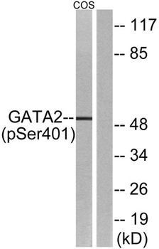 GATA-2 (phospho-Ser401) antibody