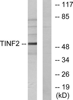 TIN2 rabbit pAb