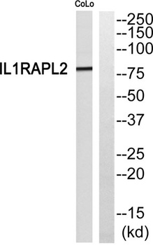 IL-1R9 rabbit pAb Antibody
