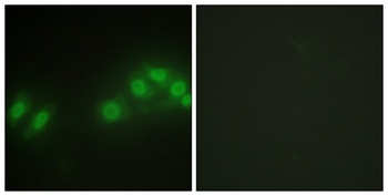 Kpm antibody