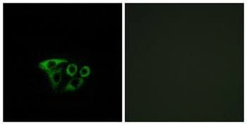 ATP5L2 rabbit pAb Antibody