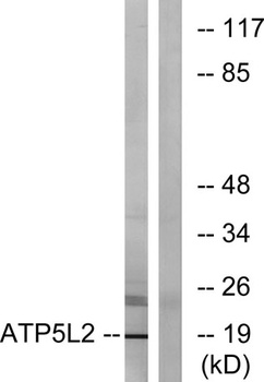 ATP5L2 rabbit pAb Antibody