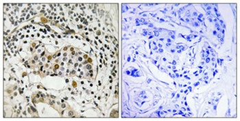 HBP1 (phospho Ser402) rabbit pAb Antibody