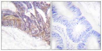LAT (phospho Tyr191) rabbit pAb