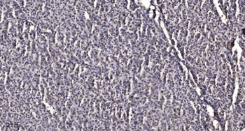 INPP5J antibody