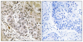 STK36 antibody