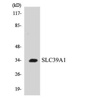 ZIP1 antibody