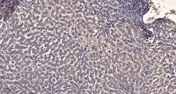 AMPD3 antibody