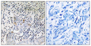 PA26 antibody